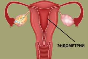 Норма эндометрия матки при климаксе
