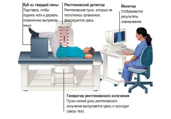 Денситометрия в москве где сделать. Обследование костей на остеопороз денситометрия. Рентгеновская денситометрия протокол. Денситометрия как проводится. Денситометрия методика проведения.