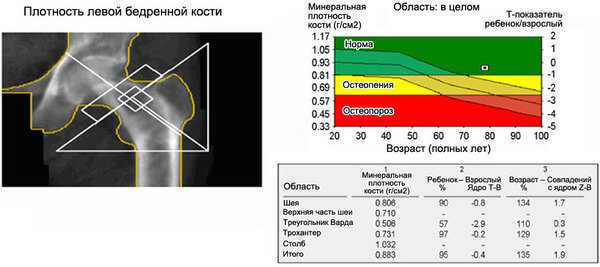 Денситометрия костей в спб адреса