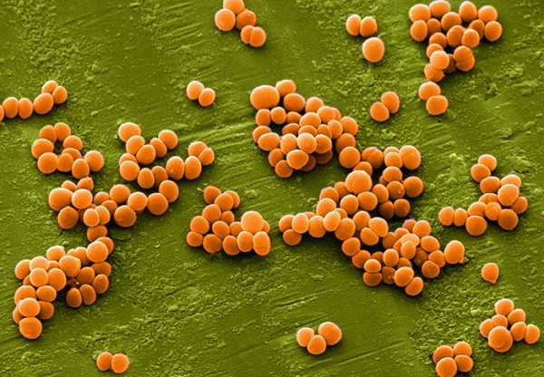 Паразитические бактерии могут вызывать заболевания