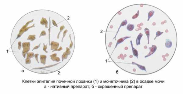 Переходный почечный эпителий