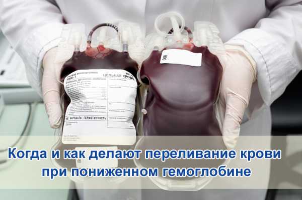 Переливание крови низкий гемоглобин