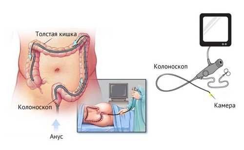 Почему слизь в кале