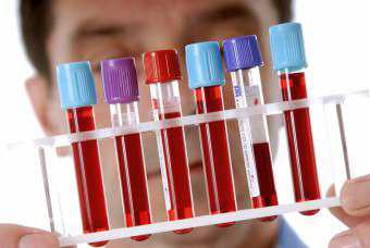 Повышенные лейкоциты и тромбоциты в крови