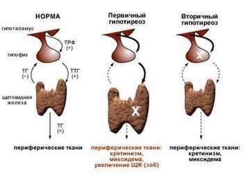 Псевдоузел щитовидной железы что это такое