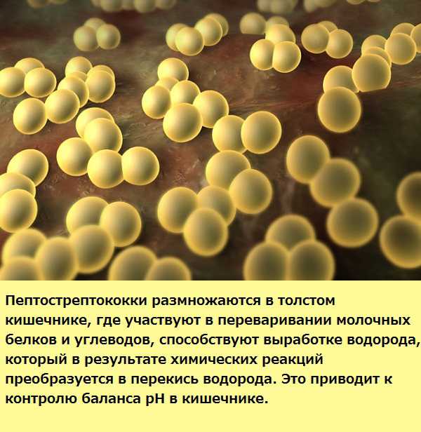 Peptostreptococcus. Золотистый стафилококк благоприятные условия. Как выглядит золотистый стафилококк. Золотистый стафилококк в кишечнике. Золотистый стафилококк где живет.