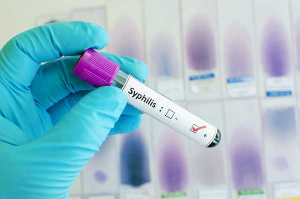 Расшифровка анализа на сифилис