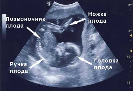 Как выглядеть беременности 19 недель