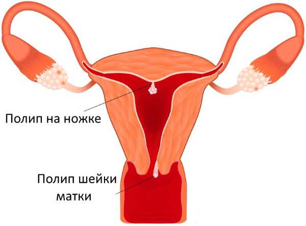 Размеры матки в норме у женщин таблица по узи