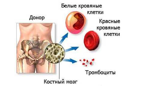 Признаки реконверсии ккм что это