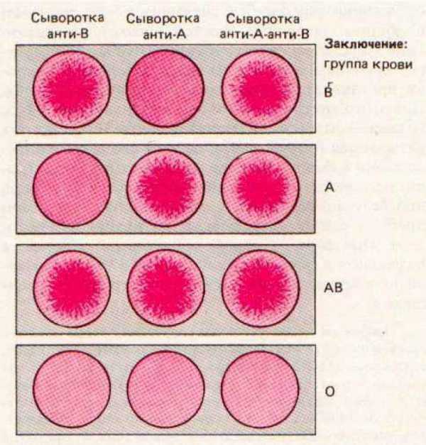 Таблица групп крови родителей и ребенка