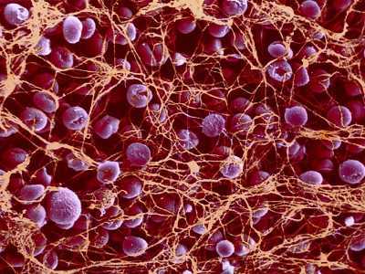 У ребенка повышенные лейкоциты и тромбоциты в крови