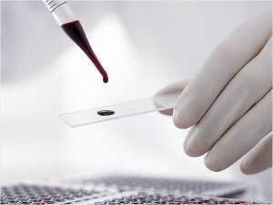 Вирусная или бактериальная инфекция анализ крови